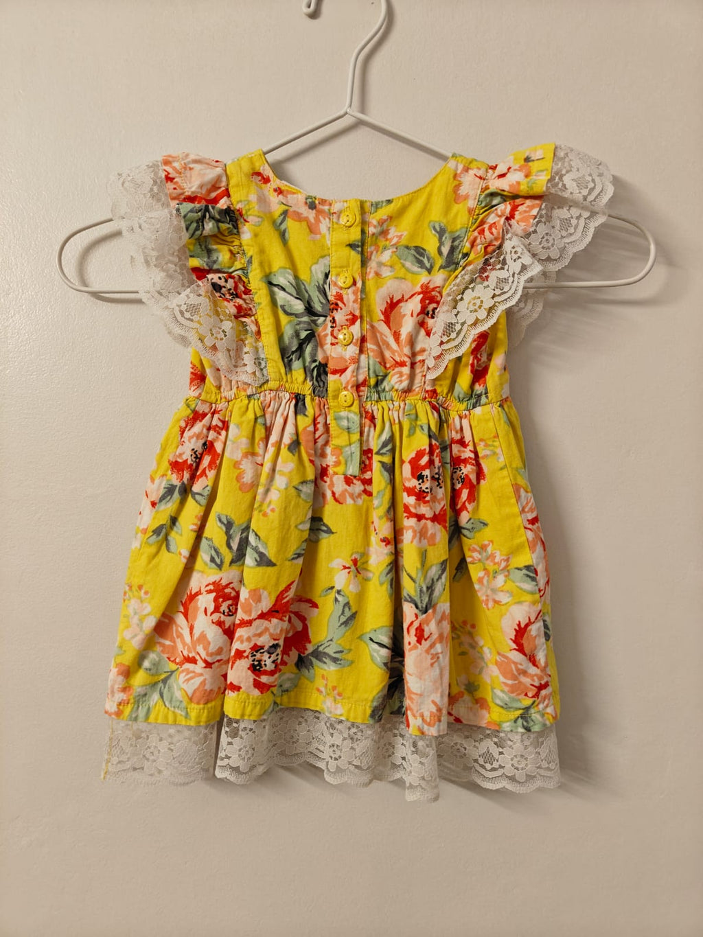 Lace Trimmed Yellow Floral Dress