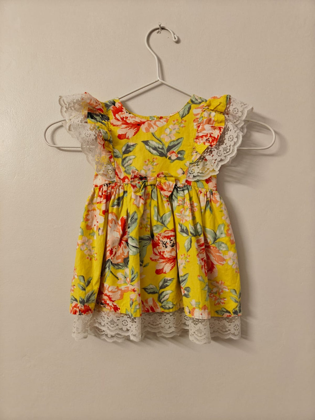 Lace Trimmed Yellow Floral Dress